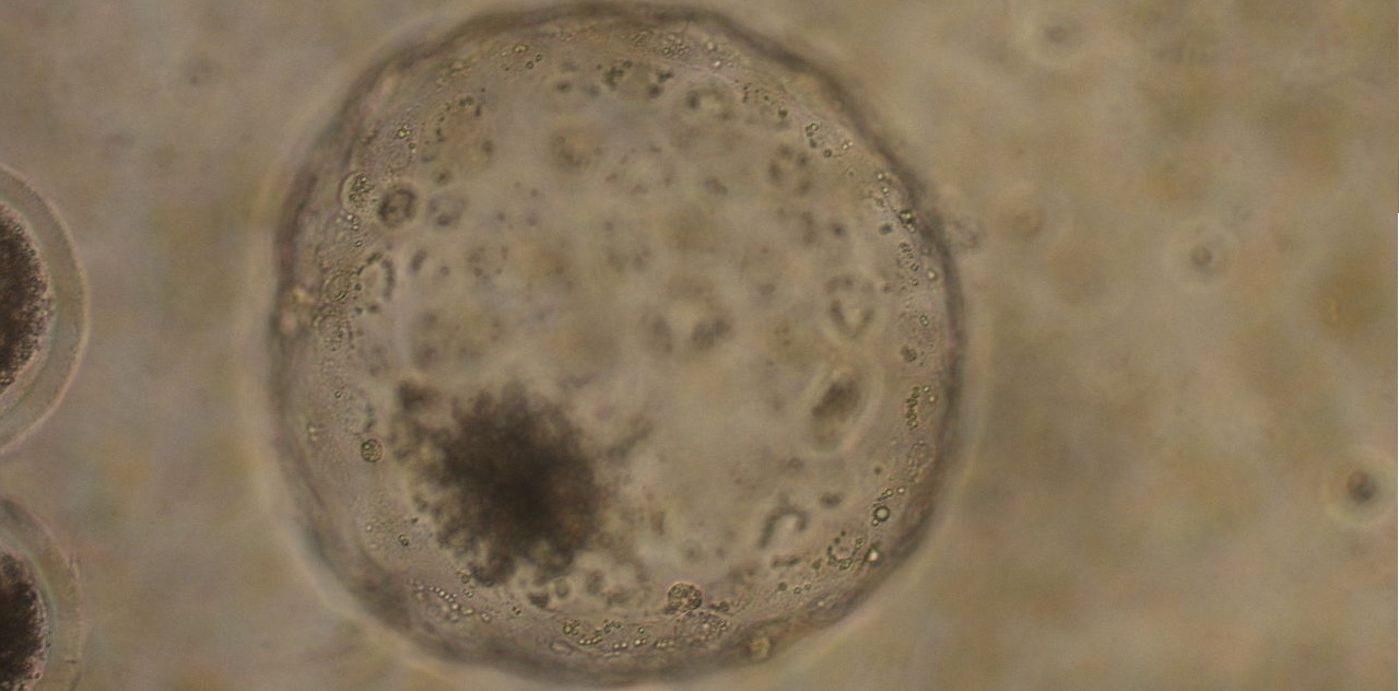 Blastocysts Culture - Currae IVF